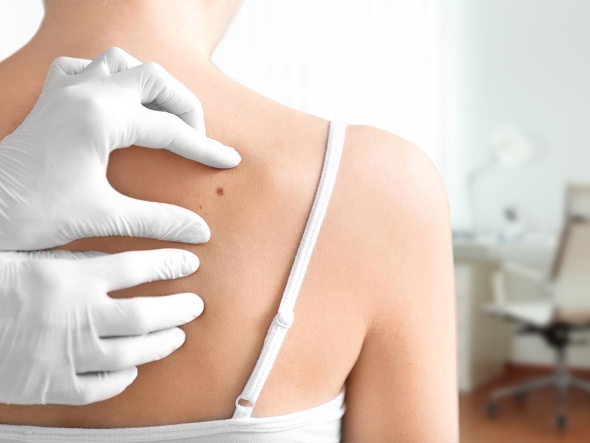 Kožní ambulance -  MUDr. Blanka Molínová